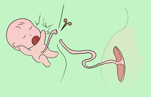 超声羞羞色电影在线观看之新生儿脐带护理你做对了吗